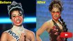 Bollywood Actresses And Their Plastic Surgeries! Before and After 2016