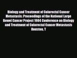 [PDF] Biology and Treatment of Colorectal Cancer Metastasis: Proceedings of the National Large