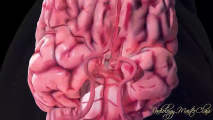 Endovascular Thrombectomy for Acute Ischemic Stroke