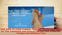 Download  TOP TIPS TO CURE FUNGAL TOENAIL INFECTION How to The Treatment and Cure of Toe Nail and  EBook