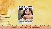 PDF  Cure Your Skin Rash The Best Secrets to Get Rid of Eczema Itch and Skin Allergies  EBook