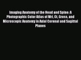 [Read PDF] Imaging Anatomy of the Head and Spine: A Photographic Color Atlas of Mri Ct Gross