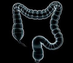 Colon cancer: Causes, Symptoms and Treatments