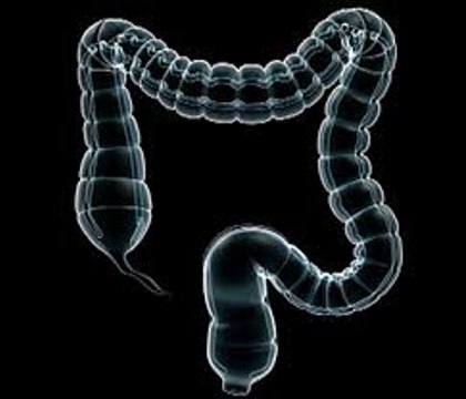 Colon cancer: Causes, Symptoms and Treatments