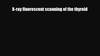 [PDF] X-ray fluorescent scanning of the thyroid Read Full Ebook