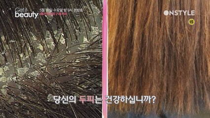 헤어 케어 레시피