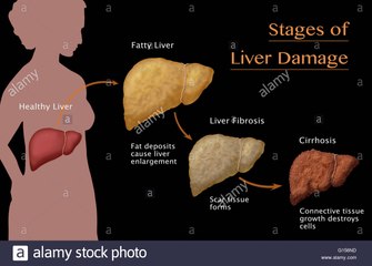 What the liver is for and How it may be damaged?