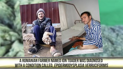 People with the Strangest Medical Conditions