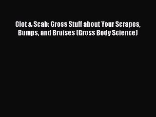 [PDF] Clot & Scab: Gross Stuff about Your Scrapes Bumps and Bruises (Gross Body Science) [Download]