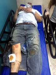 İşyerini Almak İstediği Kebapçıyı Otomobille Ezdi