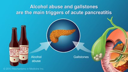 What Causes Exocrine Pancreatic Insufficiency(EPI)?