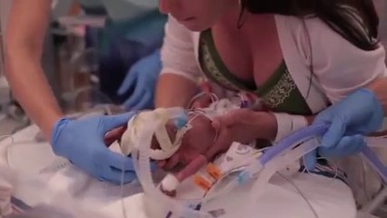 First Year Of A Baby Born 3.5 Months Premature!!