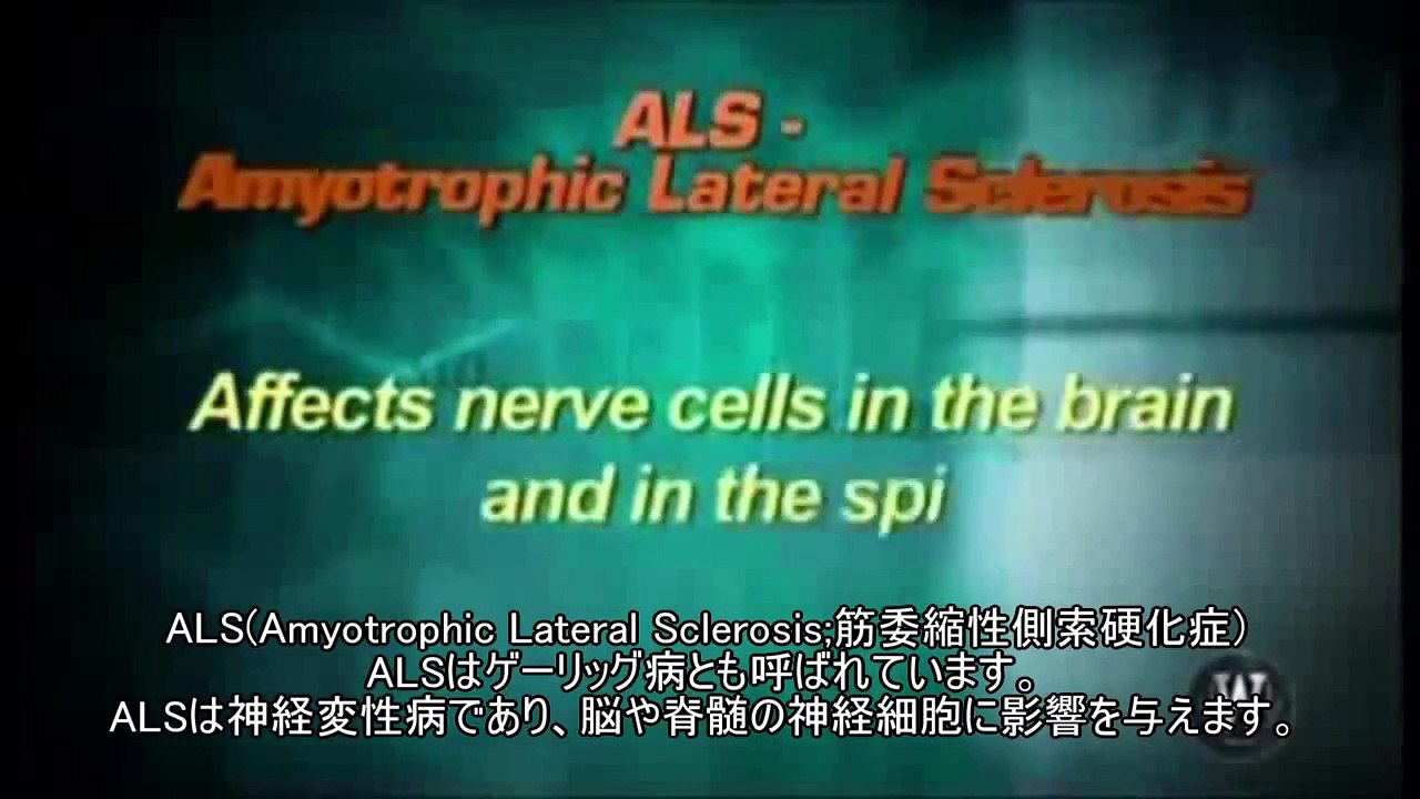 [日本語字幕]医療大麻で難病ALSの進行が止まった女性-ALS(筋萎縮性側索硬化症)-医療用大麻(マリファナ)
