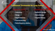 Advanced Clinics in Europe for Lung Cancer Treatment