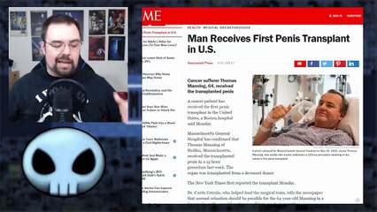 [News] WTF - Man gets first penis transplant in United States