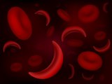 Sickle-cell disease (SCD):why symptoms such as pain and fatigue occur and how the condition is treated