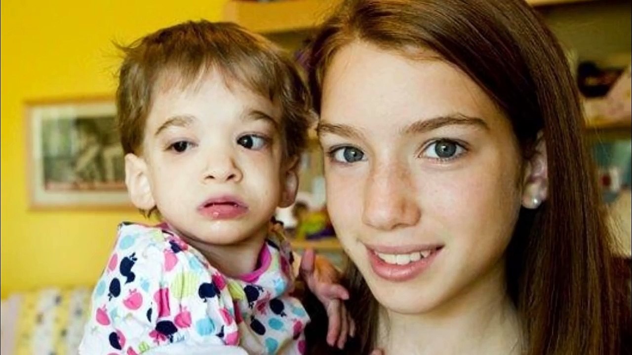 El increible caso de Brooke Greenber - Sindrome X