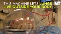 Machine Makes Unfit Lungs Suitable For Transplant