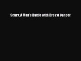 Download Scars: A Man's Battle with Breast Cancer PDF Free
