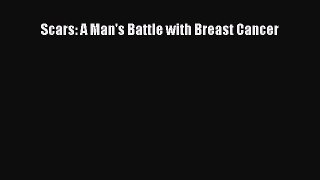 Download Scars: A Man's Battle with Breast Cancer PDF Free