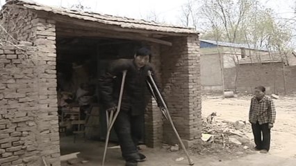 China's Tallest Man to Undergo Life-Changing Surgery For Free