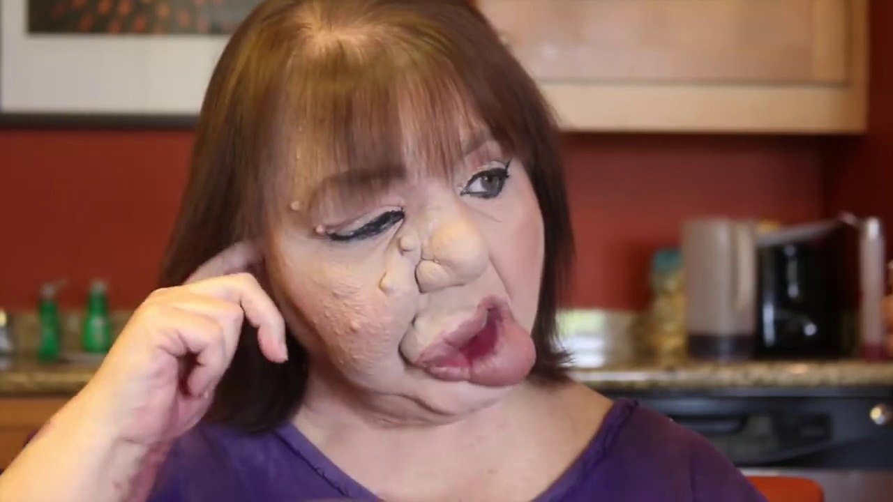 Un Youtubeur à succès utilise comme modèle sa mère, touchée par un syndrome rare