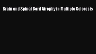 [PDF] Brain and Spinal Cord Atrophy in Multiple Sclerosis Download Online