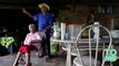 penyakit genetik kulit Langka menimpa desa Brasil - Tomonews