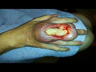 6 Most Horrible Venomous Spiders in the World