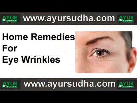 Home Remedies For Eye Wrinkles