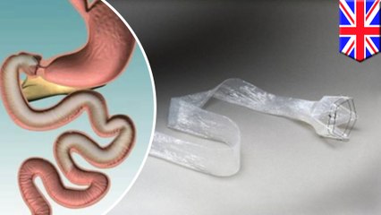 Artificial intestine can trick the brain into thinking it's digesting when it's not