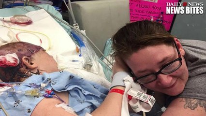The Little Girl Who Lost Her Scalp On A Carnival Ride Looks At Herself