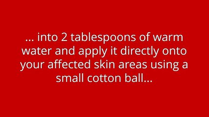 Top 5 Actually Proven Ways to Get Rid of Razor Burn & Bumps Properly Today (You Really Need to Know)