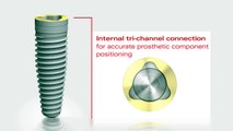 Nobel Biocare Implant Systems