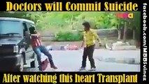 Doctors will commit suicide after watching this heart transplant