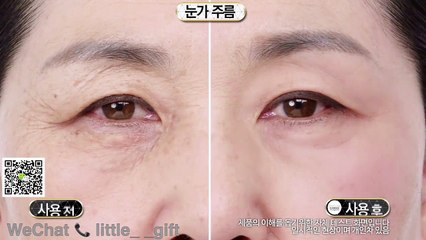 CIRMAGE Lifting Stick KOREA 高浓缩美容棒 MAX CLINIC