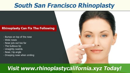 WHO IS THE BEST DENTIST IN EL DORADO HILLS? THIS GUY!...ER...RHINO!