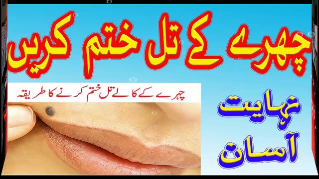 how to remove black spots from face - chehre ke til hatane ka tarika urdu hindi