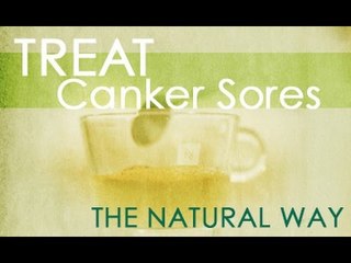 The Alternative - EP26 - Canker Sore Remedy - Myx TV