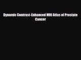 [PDF] Dynamic Contrast-Enhanced MRI Atlas of Prostate Cancer Read Online