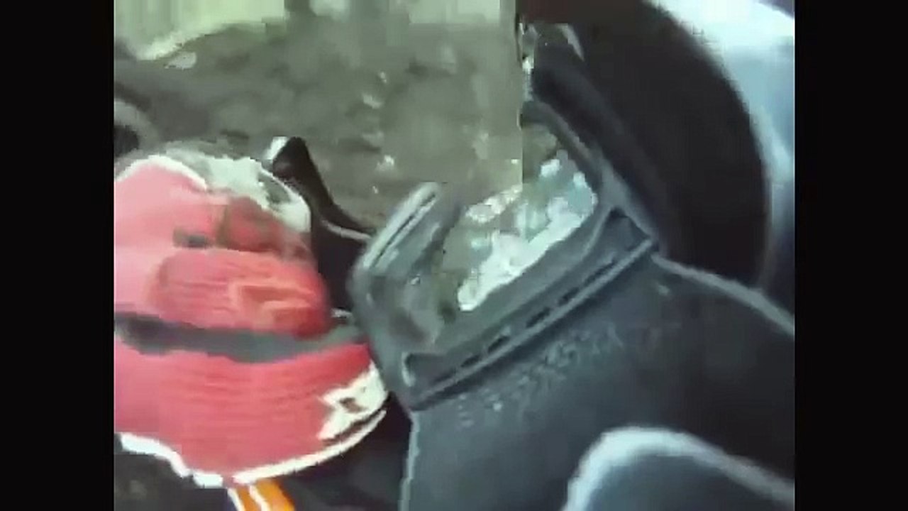 Dirt Bike Crash runs into tree, bone sticking out! YouTube