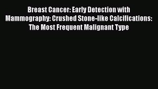 Read Breast Cancer: Early Detection with Mammography: Crushed Stone-like Calcifications: The