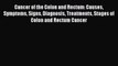 Read Cancer of the Colon and Rectum: Causes Symptoms Signs Diagnosis Treatments Stages of Colon