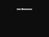 Read Liver Metastases Ebook Free
