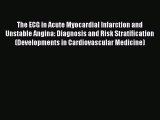 [PDF] The ECG in Acute Myocardial Infarction and Unstable Angina: Diagnosis and Risk Stratification