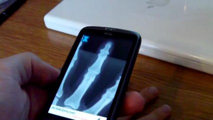 X-Ray Scanner dla Android