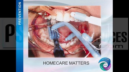 Benefits And Services