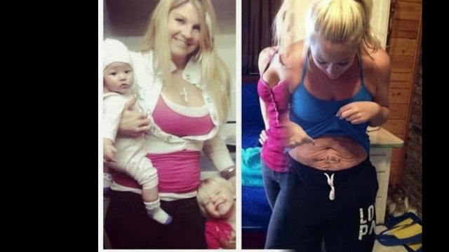 Before and After Weight Loss Pictures - Weight Loss Transformation