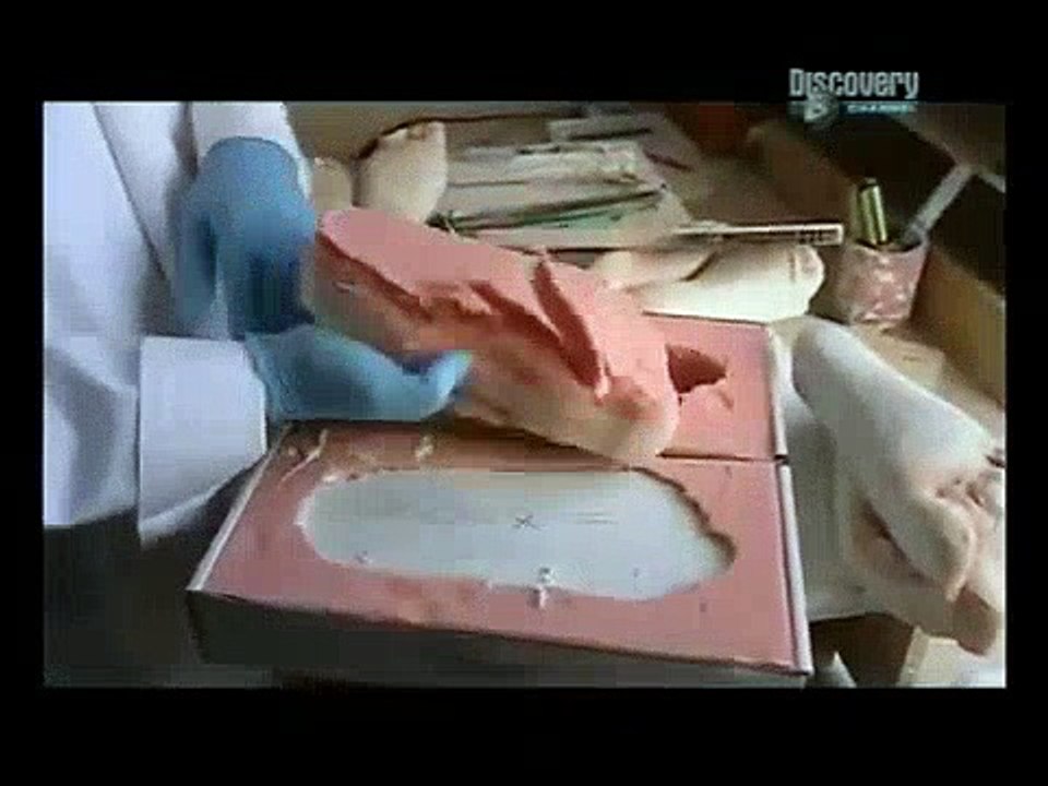 Nasıl Yapılır How Its Made - Ortapedik Malzemelerin Yapımı | Belgesel