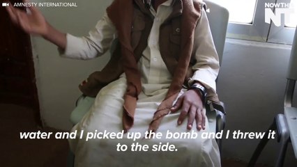 Children In Yemen Getting Injured By Leftover Bombs